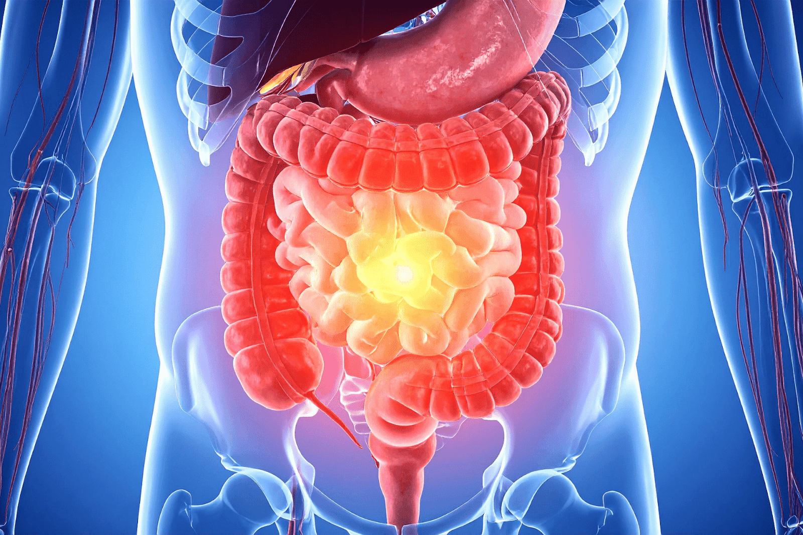 3D illustration of the human digestive system highlighting intestinal inflammation.