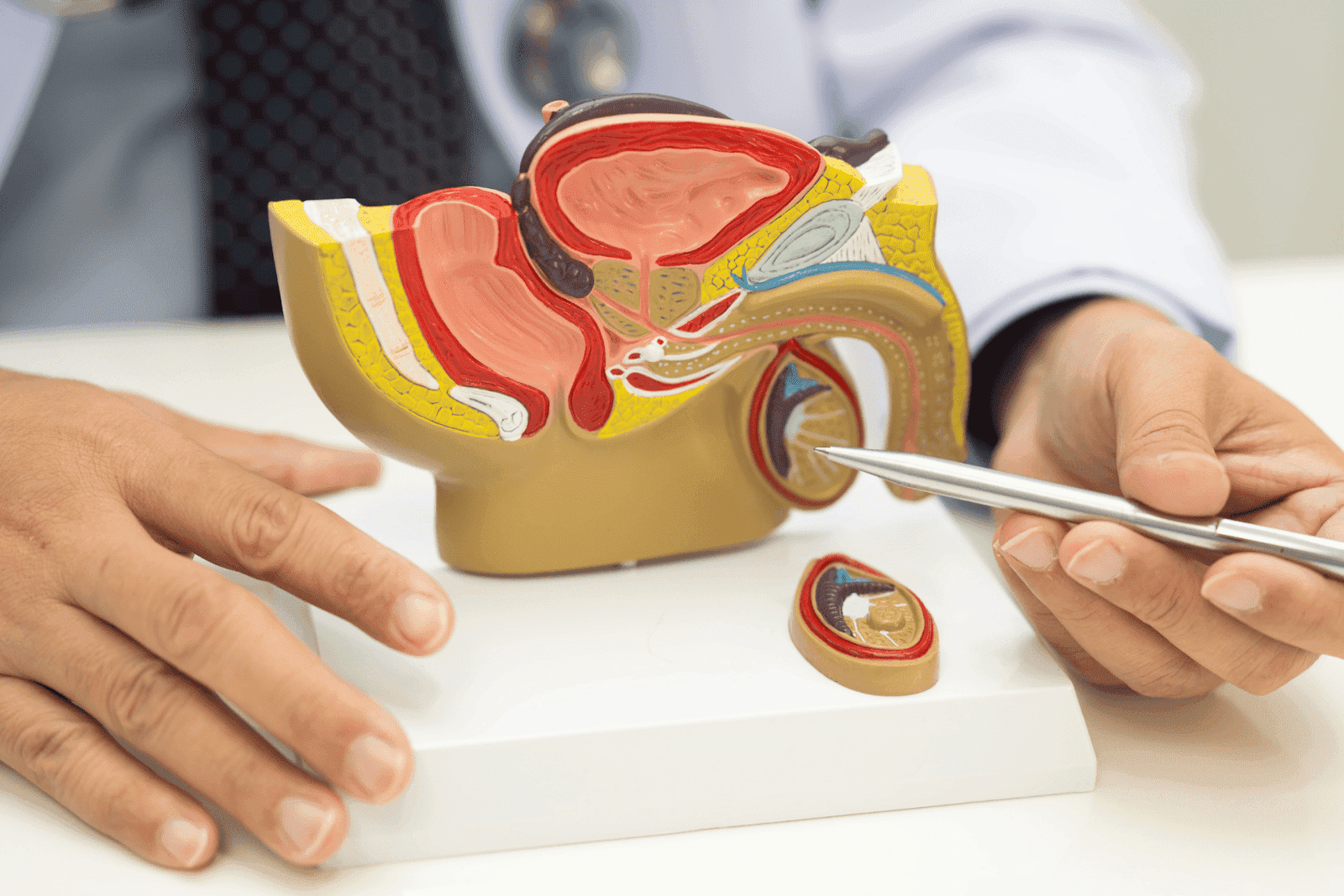 A doctor points to a medical model of the male reproductive system.