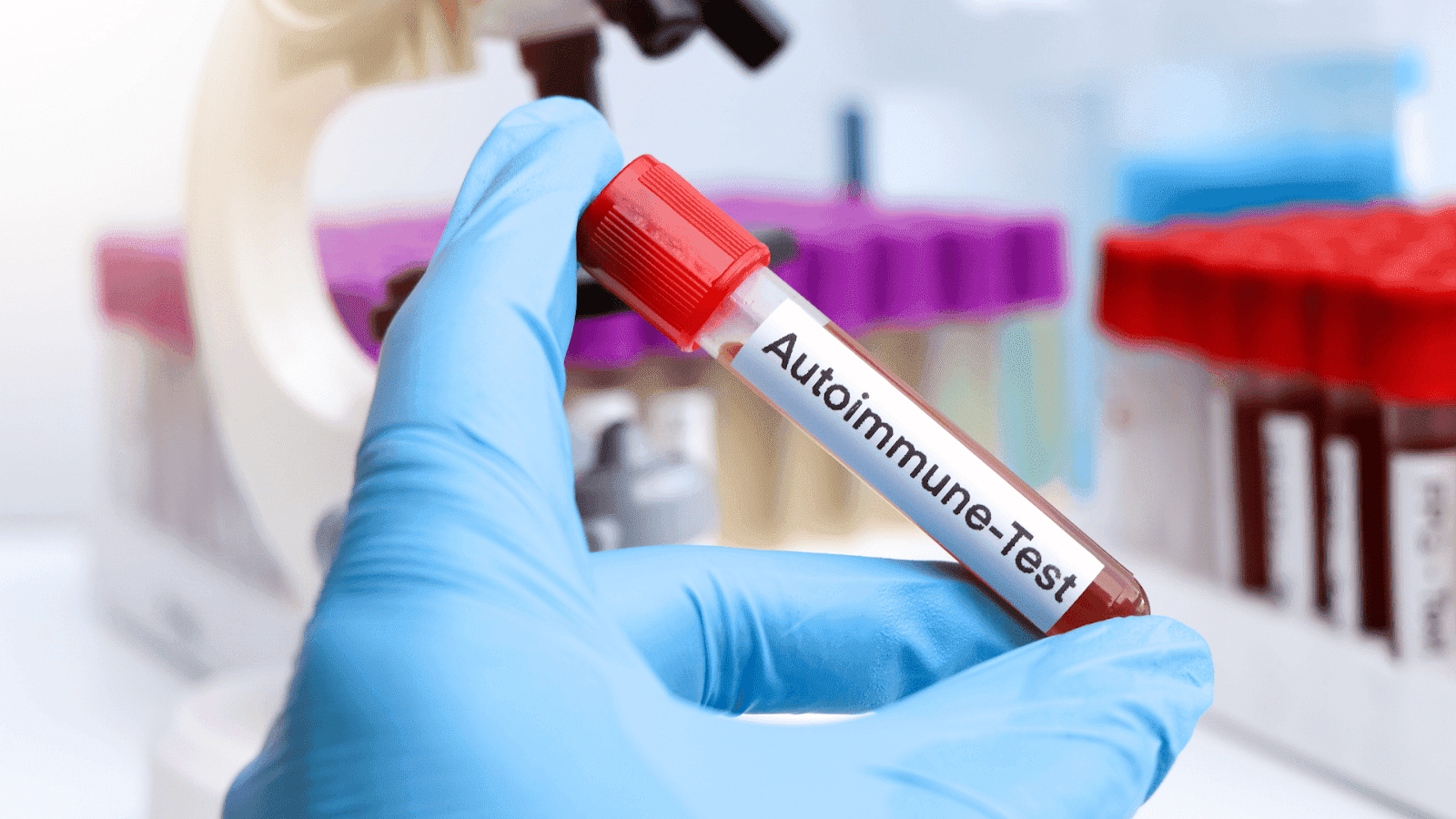 A gloved hand holds a blood vial labeled "Autoimmune-Test"