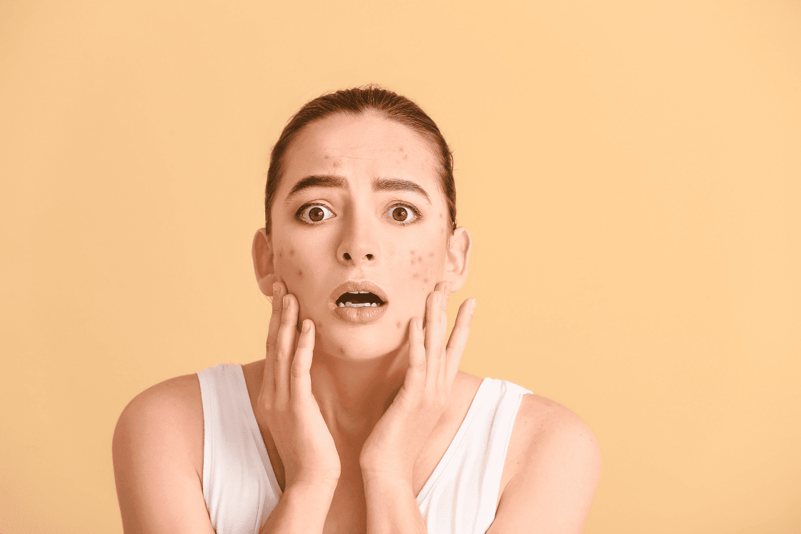 A woman looking shocked while touching her face, which has noticeable acne or skin irritation.