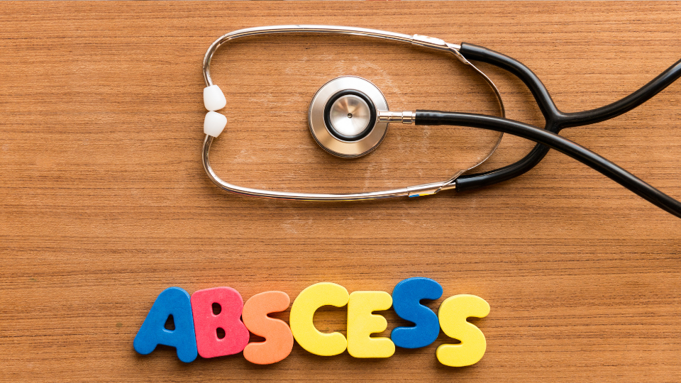 Stethoscope and letters spelling "Abscess" on table