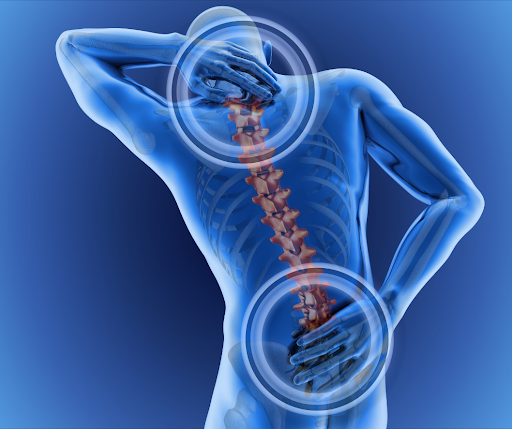 Illustration of spine highlighting upper and lower back pain areas