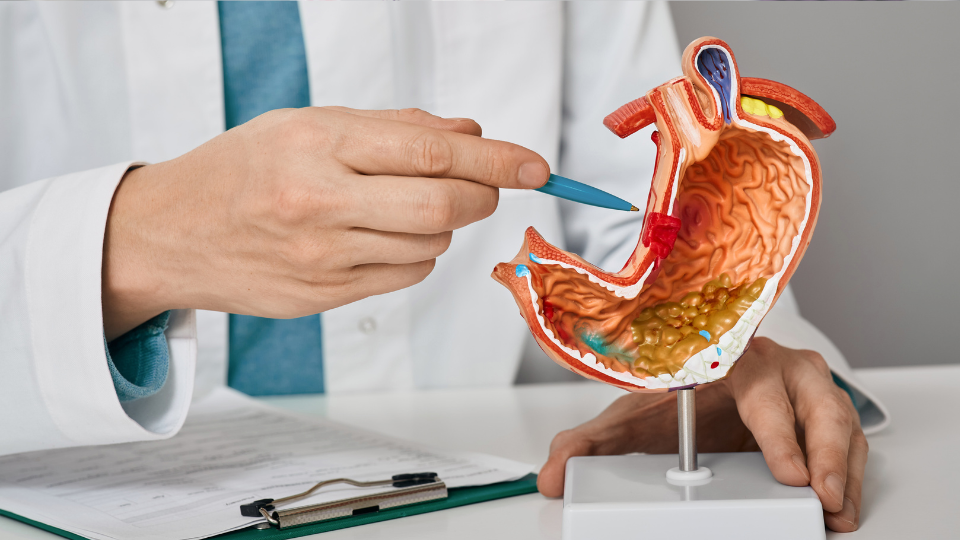 Doctor pointing to anatomical model of bladder with a pen