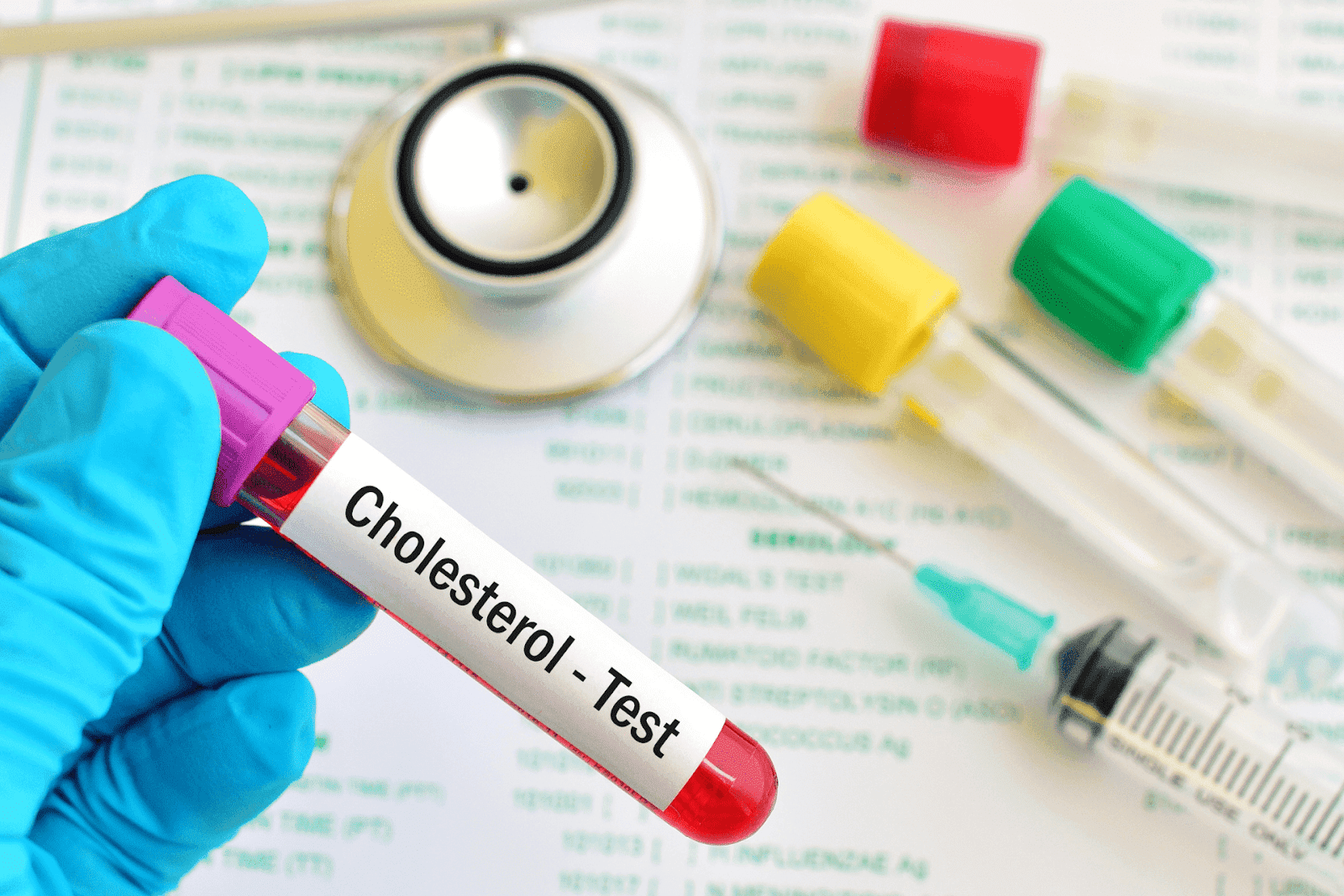 Blood sample for cholesterol test held by a gloved hand with medical tools in the background.