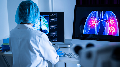Doctor viewing computer screen showing illustration of lungs with pneumonia
