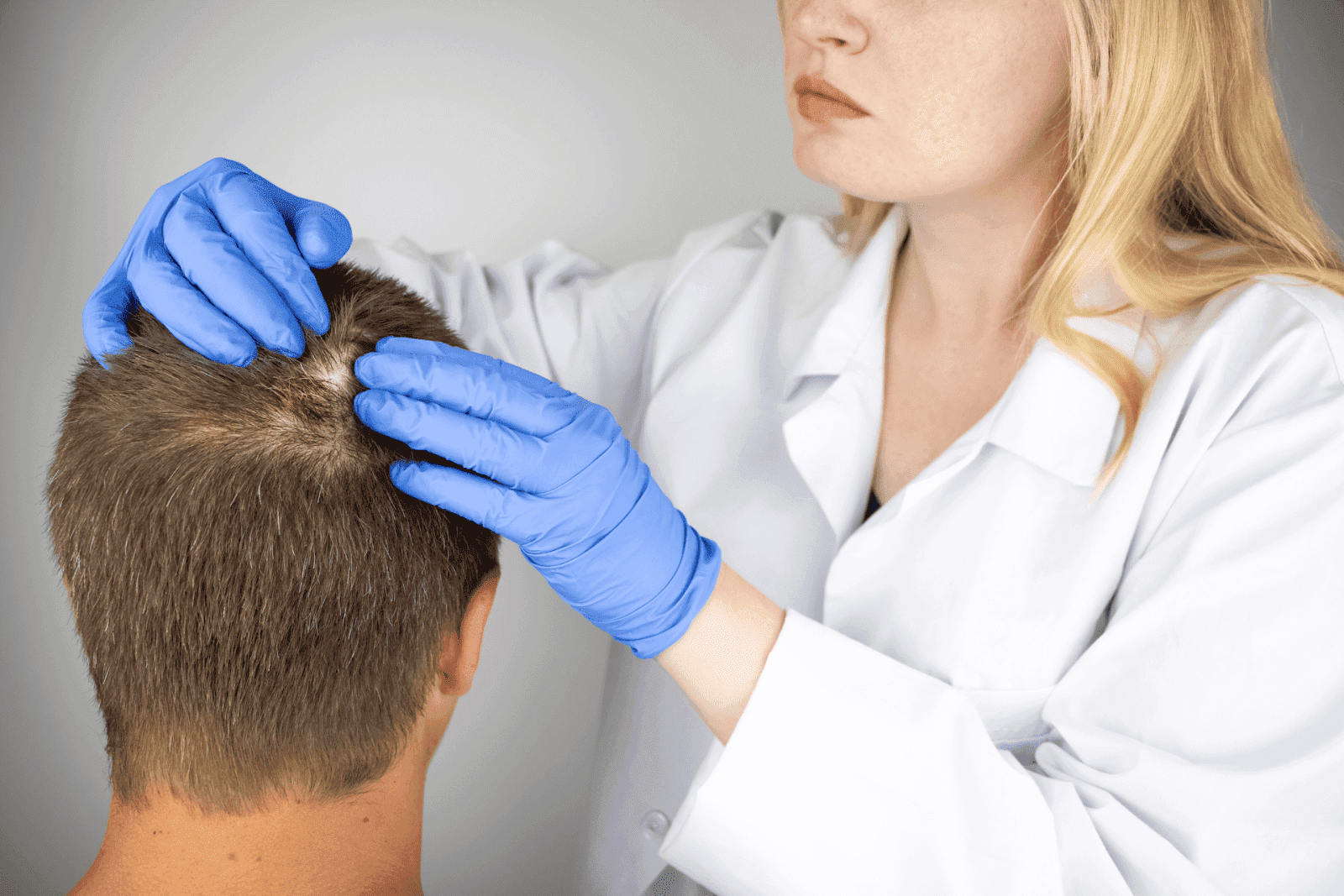 Doctor examining patient’s scalp.