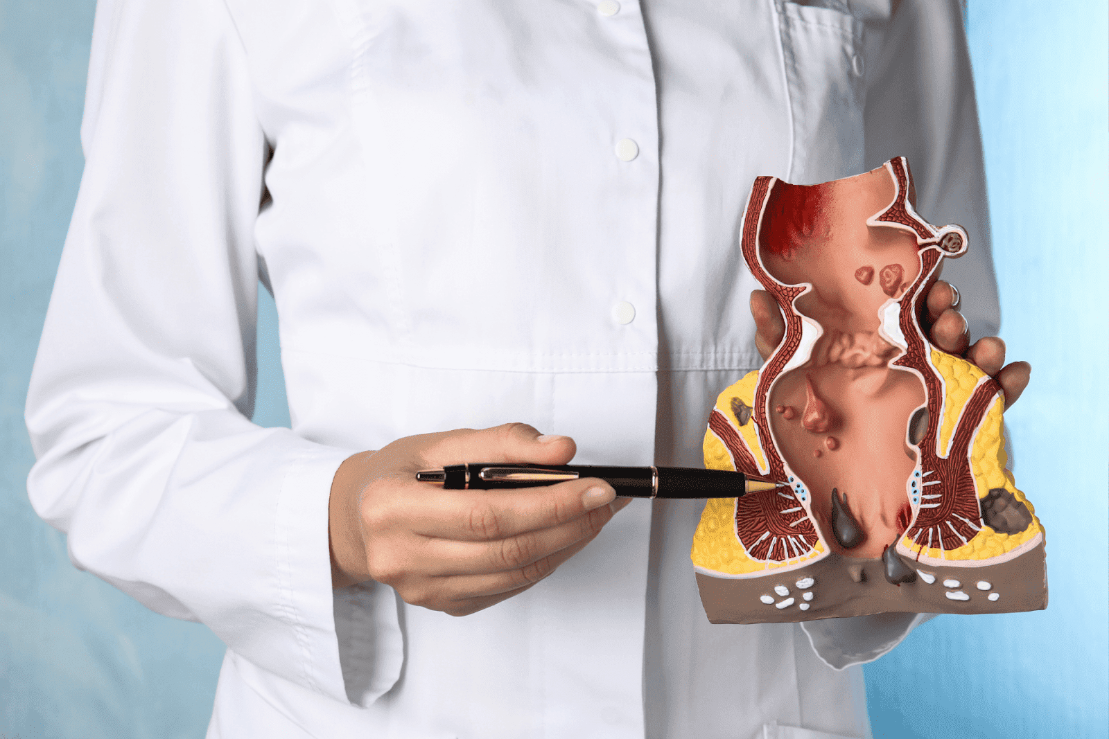 Doctor holding anatomical model of rectum and anus, pointing with pen