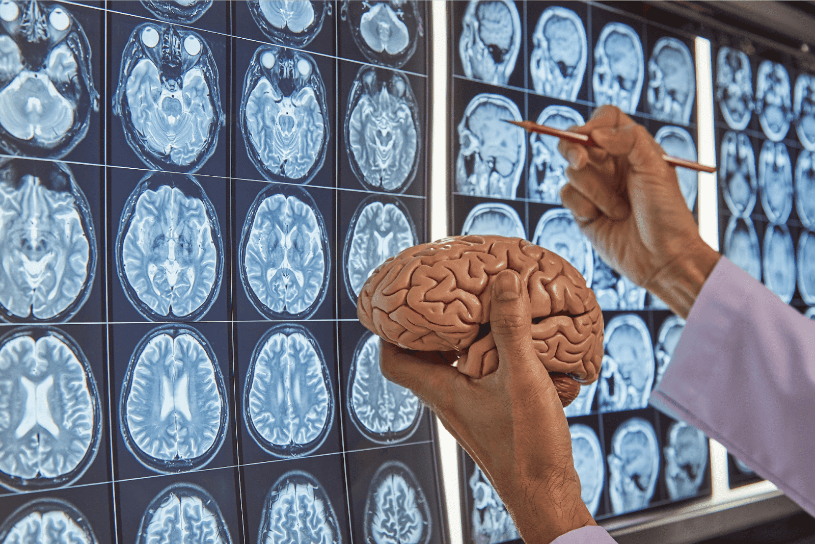 Doctor holding brain model and pointing at brain scans on a light board