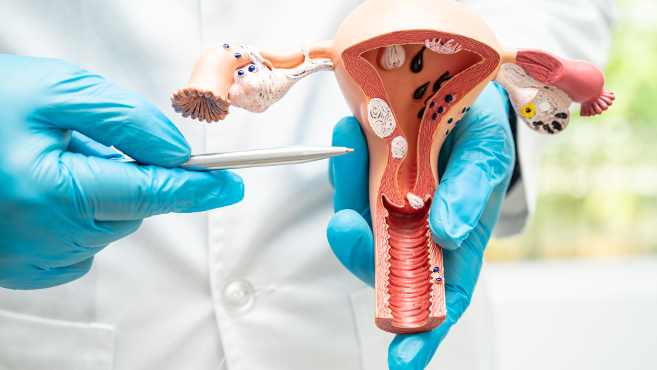 Doctor pointing to anatomical model of uterus