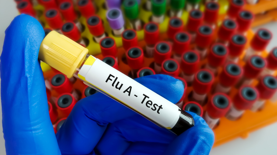 Vial of blood being tested for the flu