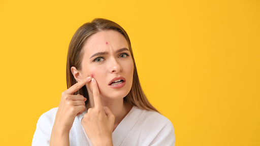 Woman pointing to red spot on right cheek