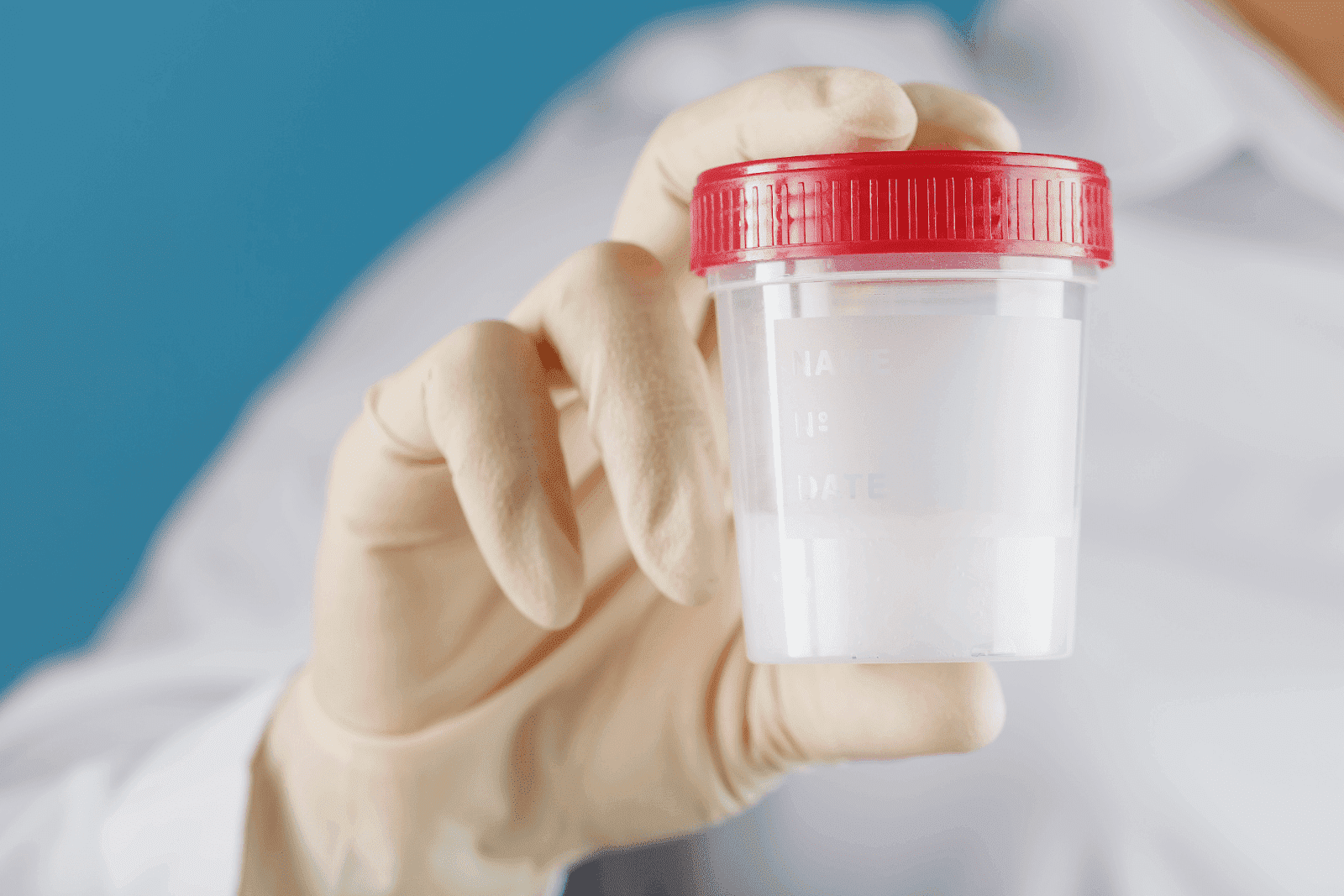 Gloved hand holding a specimen container.