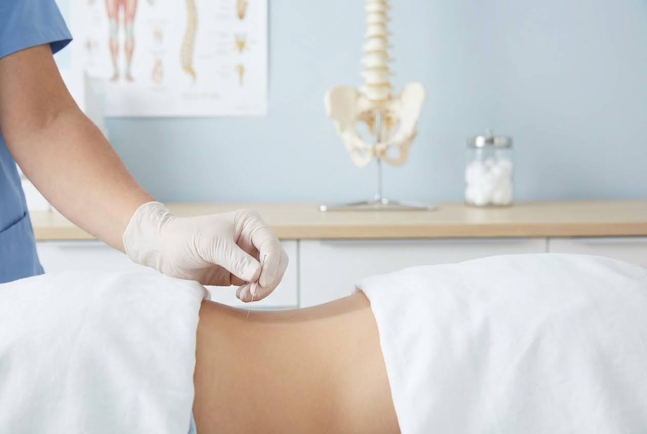 Gloved hand inserting an acupuncture needle into a person's lower back, with a spine model and anatomical chart in the background.