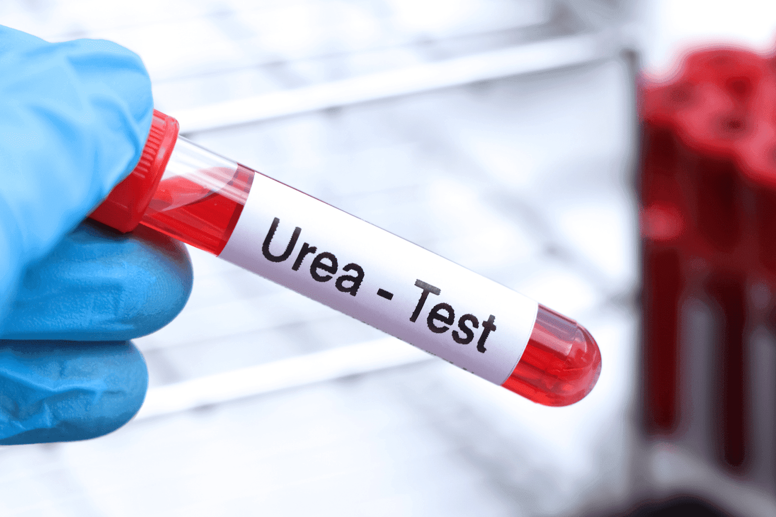 Hand in a blue glove holding a blood sample tube labeled “Urea - Test”