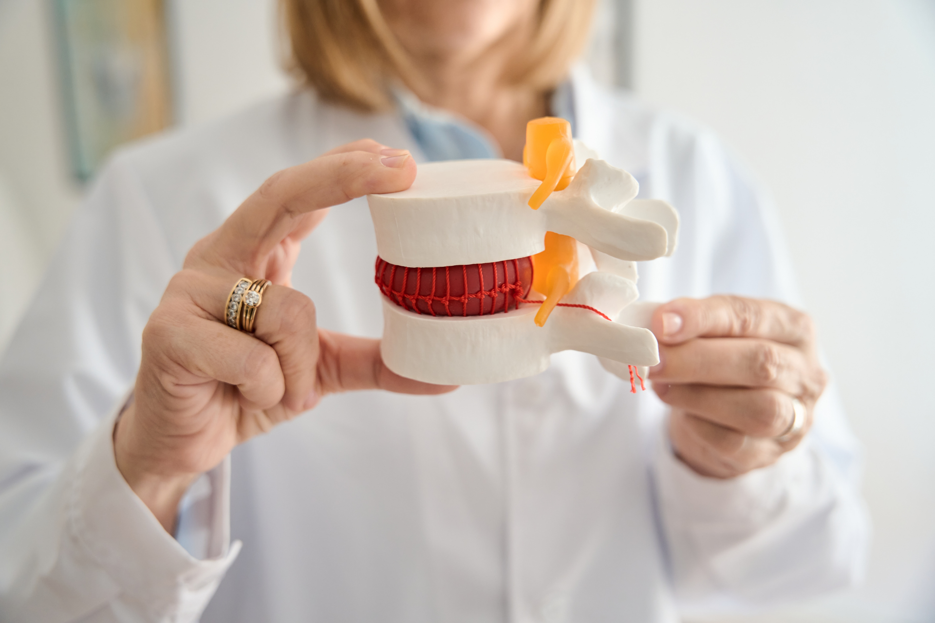 Healthcare professional holding a model of vertebrae and spinal disc to explain spine anatomy