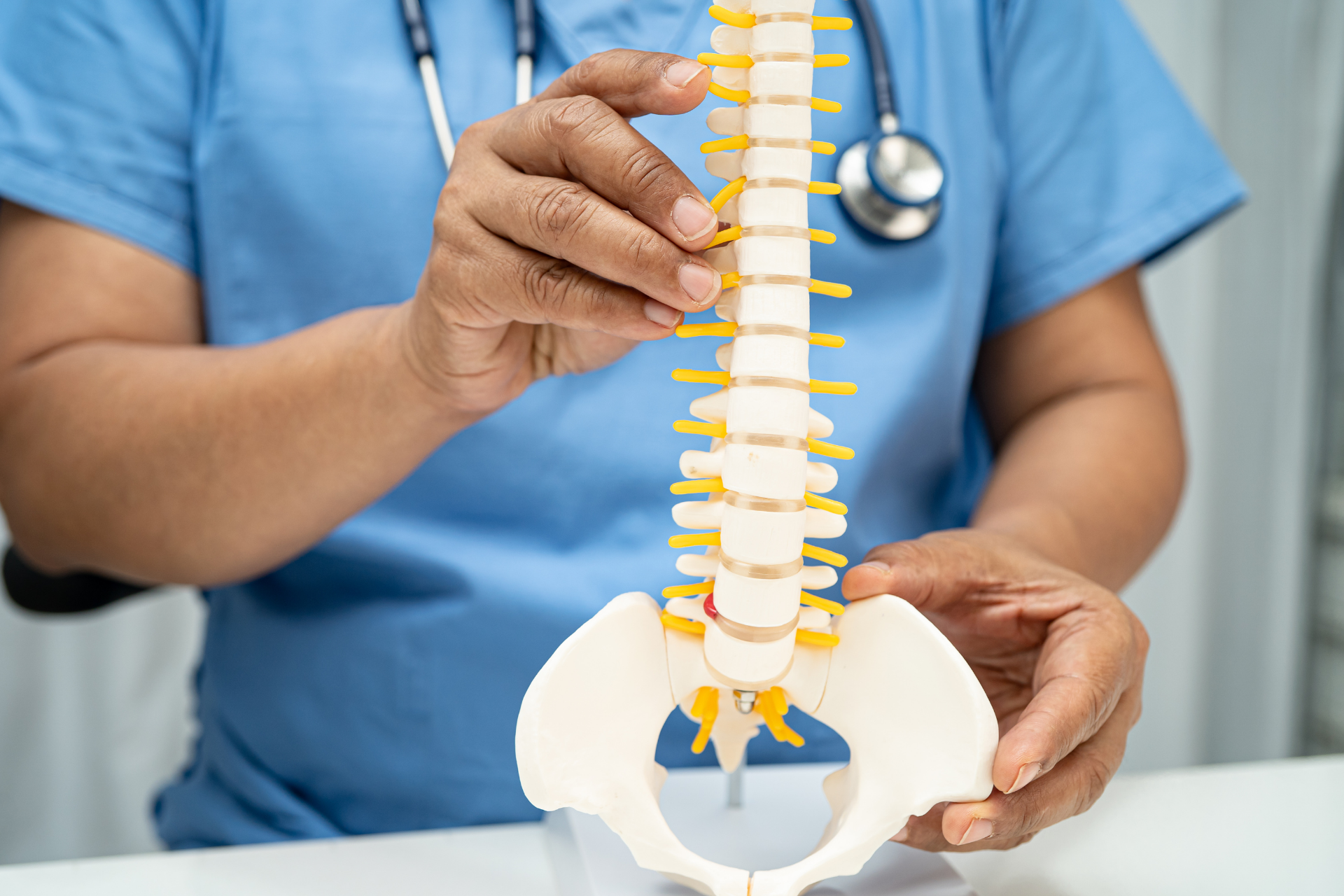 Healthcare professional holding a spine model to explain a herniated disc