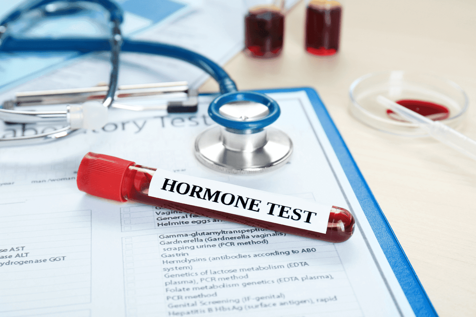 Hormone test blood sample tube on a lab report with a stethoscope nearby.