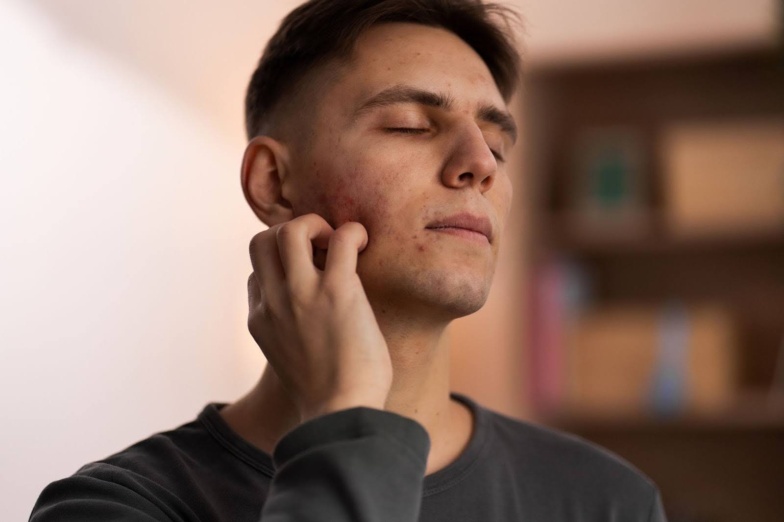 Man Scratching an Itchy Face