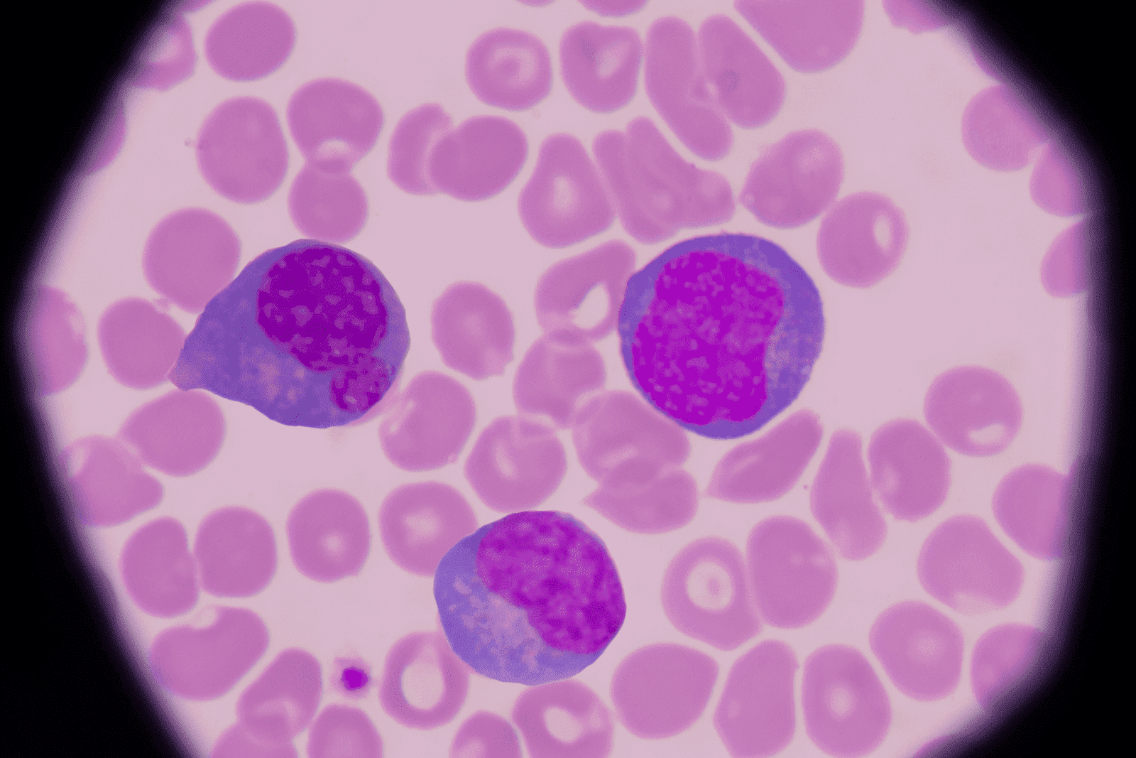 Microscopic view of red and white blood cells