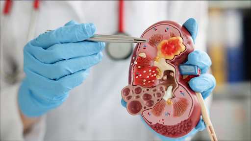 Doctor pointing to anatomical model of a kidney