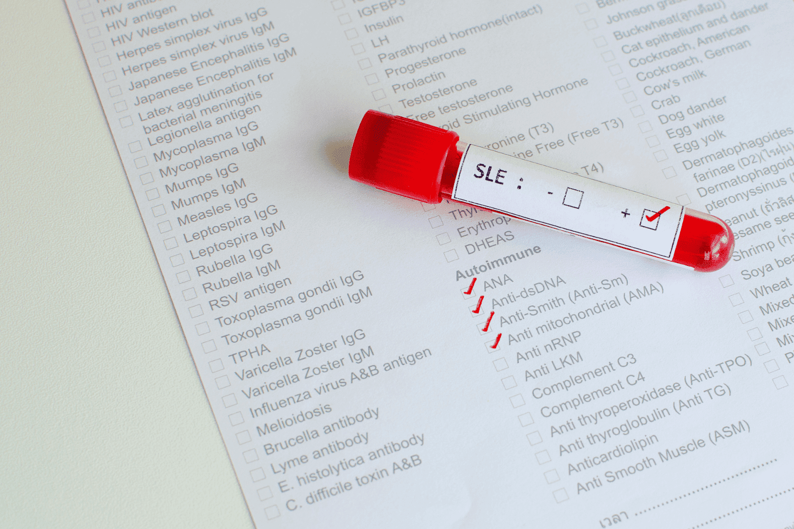 Positive SLE blood test tube placed on a checklist of autoimmune markers.