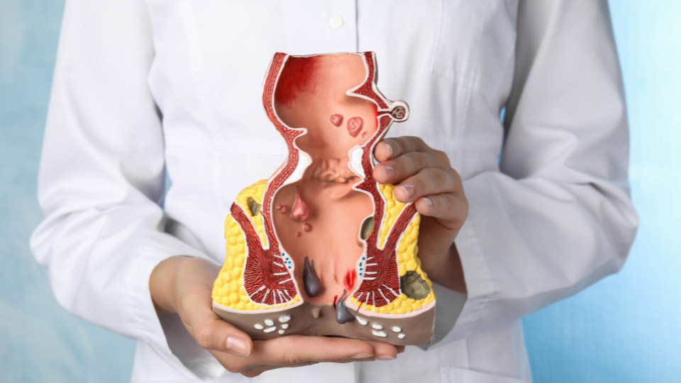 Doctor holding anatomical model of rectum