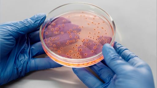 Medical professional holding a sample of a bacteria