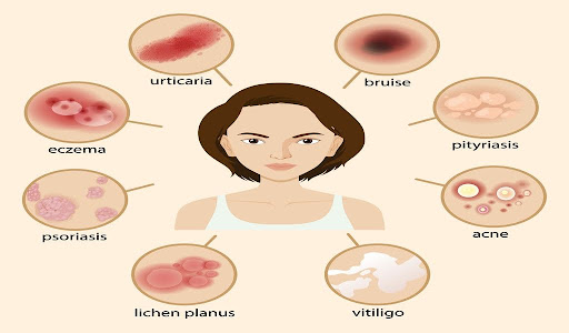This chart displays various skin diseases