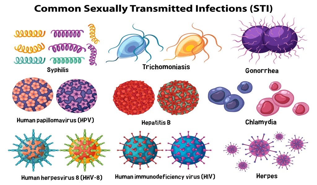 This graphic shows different forms of vaginal infections