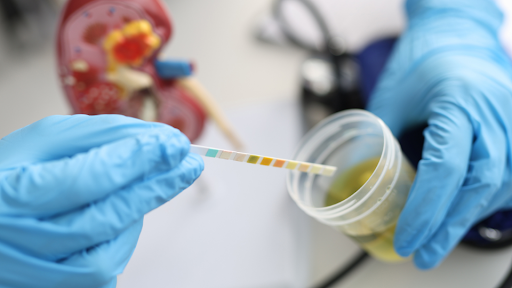 Medical professional testing a urine sample