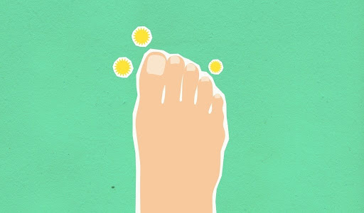 This illustration indicates toenails with germs