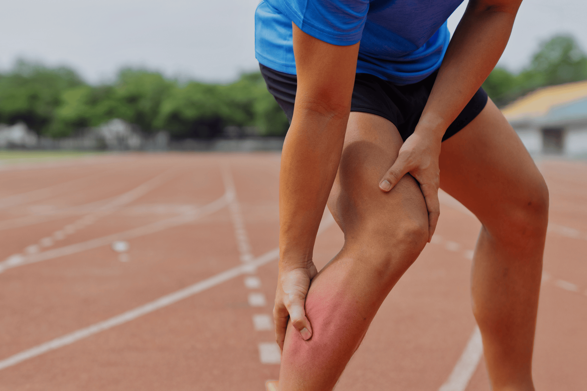 A runner holding his lower leg with visible redness from a muscle strain on a track.