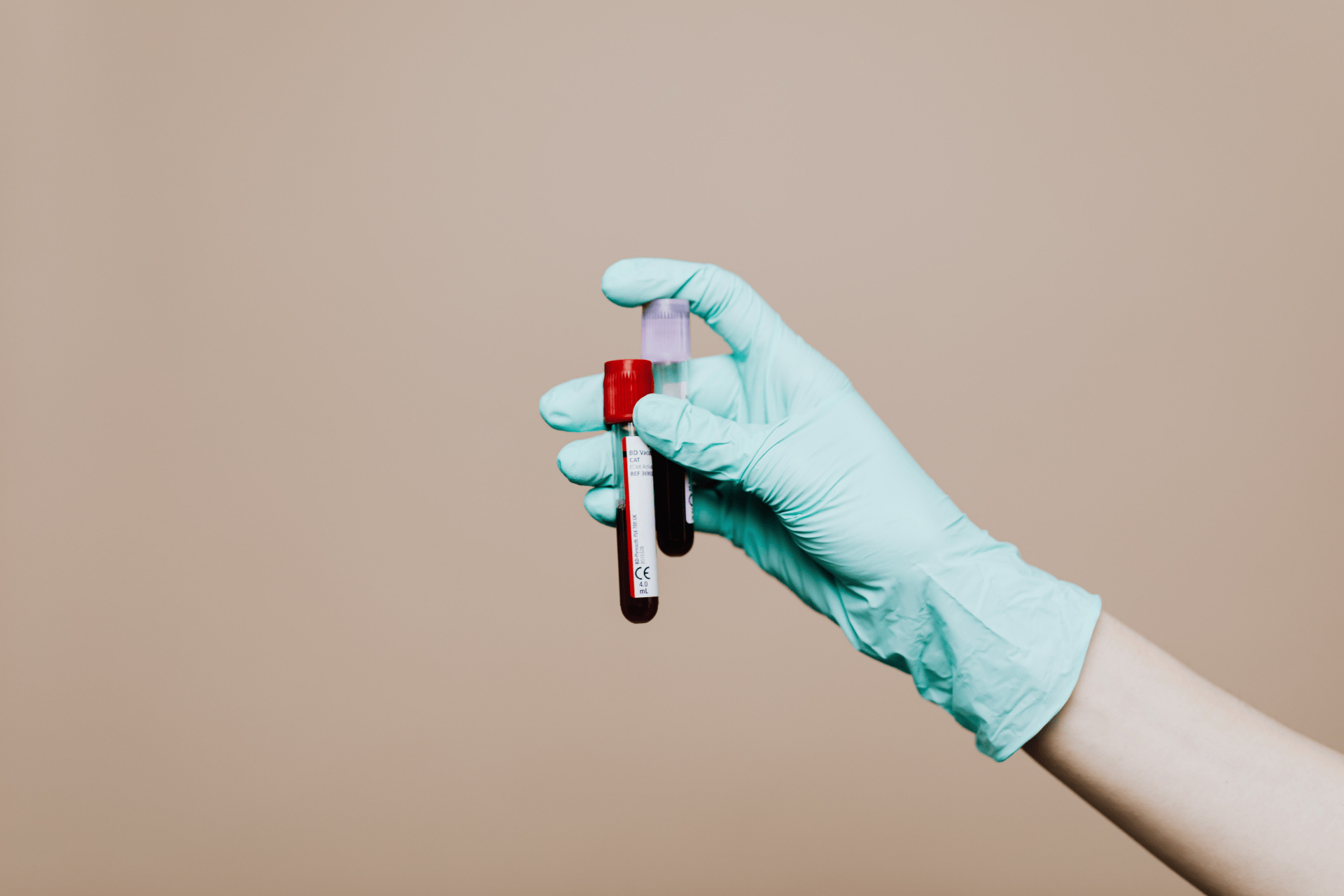 Gloved hand holding two blood sample tubes against a plain background.