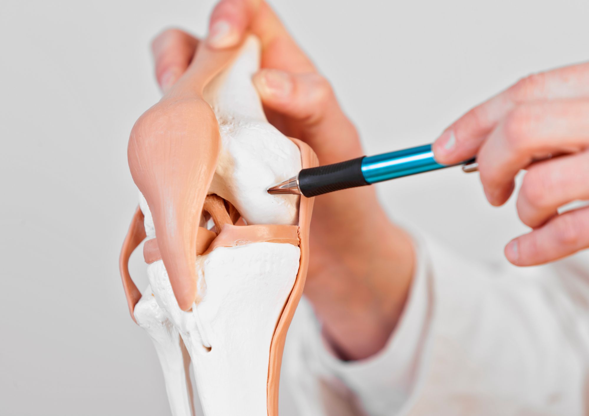 Doctor holding an anatomical model of a knee