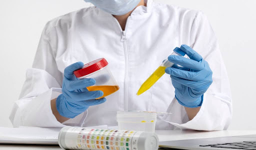 Lab worker holding a test tube with a urine sample and ratio chart.