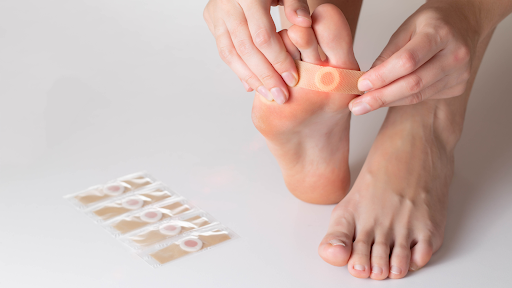 Wart on feet of a person