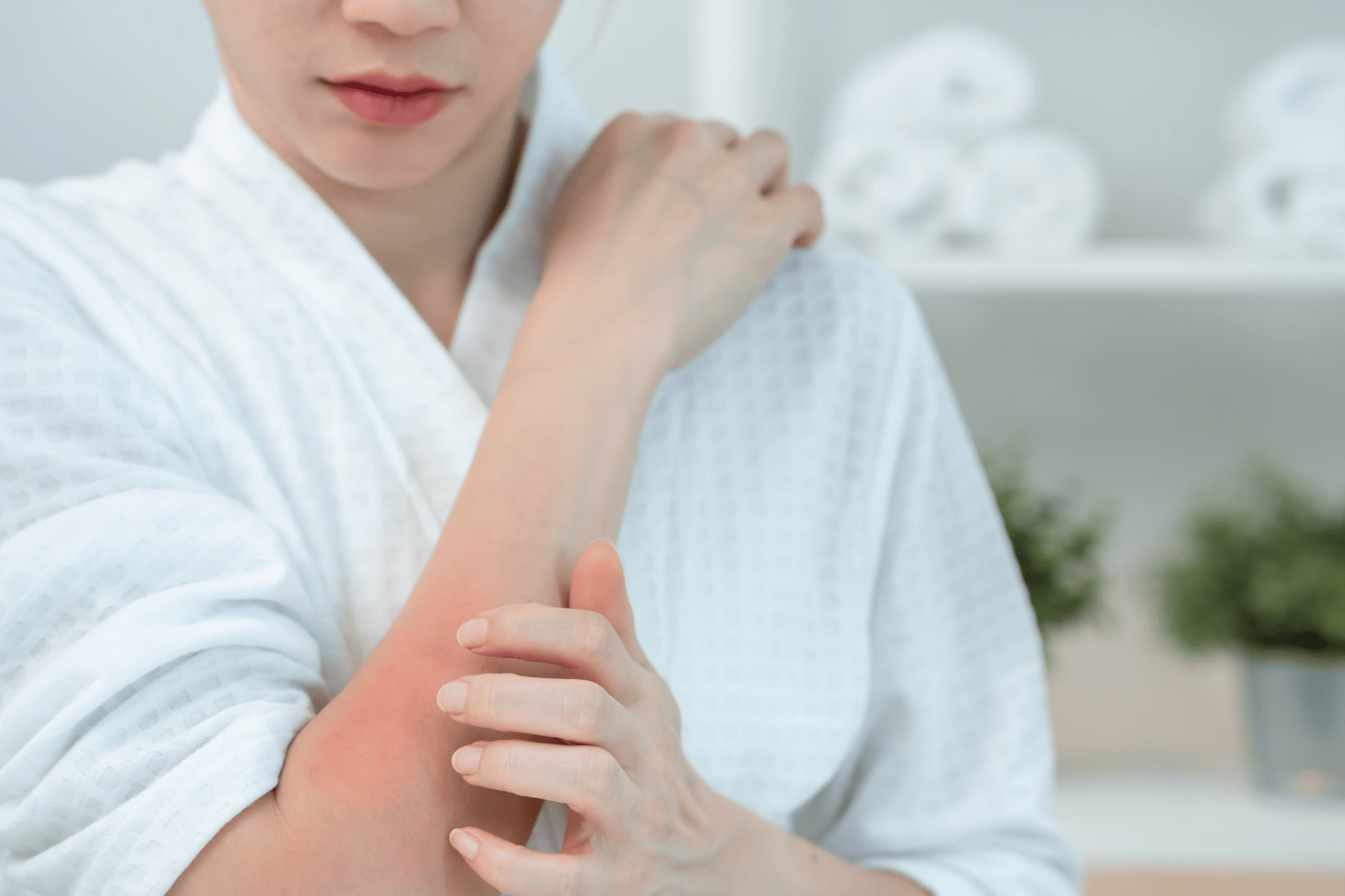 Person in a robe scratching a red, irritated rash on their arm.