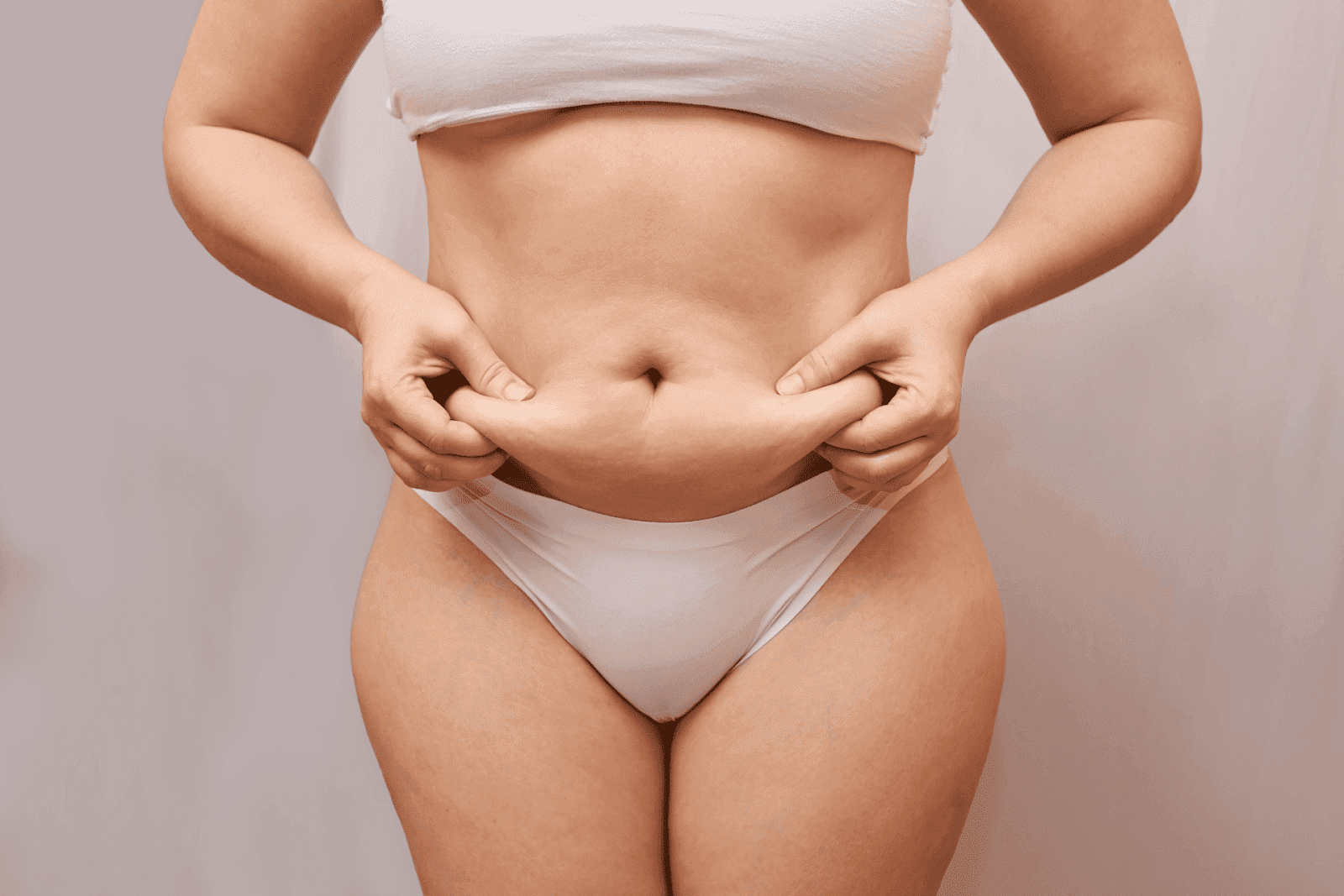 Woman in underwear pinching excess fat on her lower abdomen.