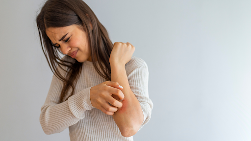 Woman scratching her arm.