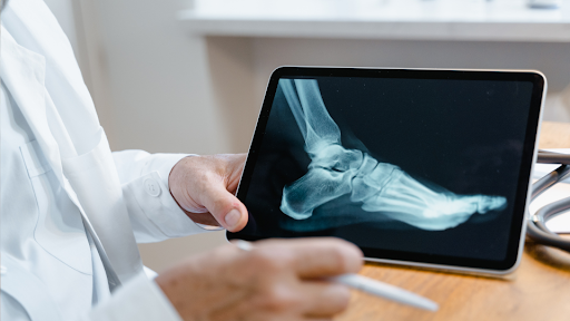 Doctor holding tablet with an xray of a foot